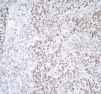 hnRNP D/AUF1/HNRNPD Rabbit Polyclonal Antibody