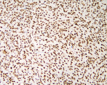 hnRNP D/AUF1/HNRNPD Rabbit Polyclonal Antibody