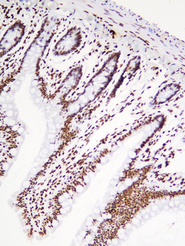 hnRNP D/AUF1/HNRNPD Rabbit Polyclonal Antibody
