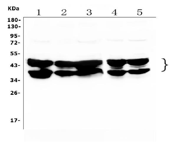 hnRNP D/AUF1/HNRNPD Rabbit Polyclonal Antibody