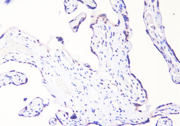 c-Maf/MAF Rabbit Polyclonal Antibody