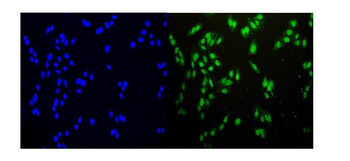 HEC1/HEC/NDC80 Rabbit Polyclonal Antibody