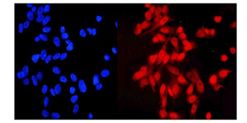HEC1/HEC/NDC80 Rabbit Polyclonal Antibody