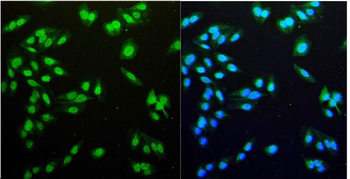 HEC1/HEC/NDC80 Rabbit Polyclonal Antibody
