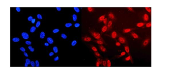Neurofibromin/NF1 Rabbit Polyclonal Antibody