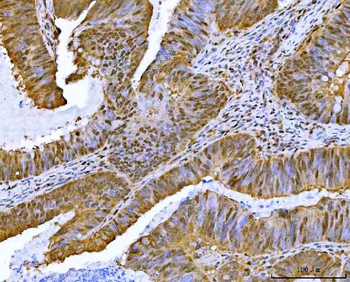 Neurofibromin/NF1 Rabbit Polyclonal Antibody