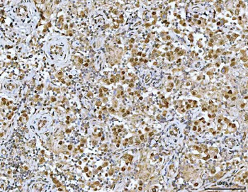 Neurofibromin/NF1 Rabbit Polyclonal Antibody