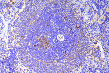 SCN11A Rabbit Polyclonal Antibody
