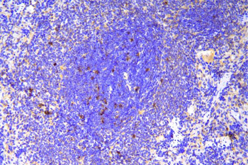 SCN11A Rabbit Polyclonal Antibody