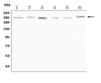 SCN11A Rabbit Polyclonal Antibody