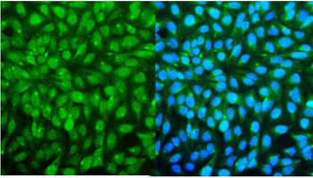 SMC4 Rabbit Polyclonal Antibody