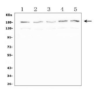 SMC4 Rabbit Polyclonal Antibody
