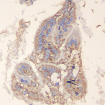 TRAF6 Antibody