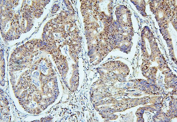 SAE2/UBA2 Mouse Monoclonal Antibody