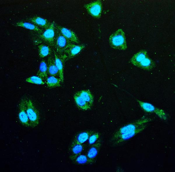 IDH1 Mouse Monoclonal Antibody