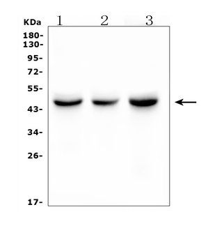 IDH1 Mouse Monoclonal Antibody
