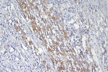 CD46 Mouse Monoclonal Antibody