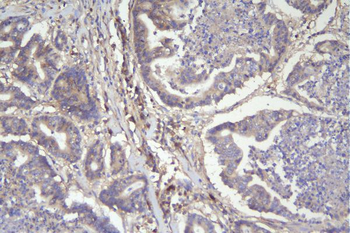 CD46 Mouse Monoclonal Antibody