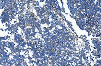 GAA Mouse Monoclonal Antibody