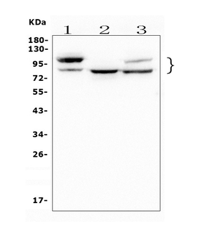 GAA Mouse Monoclonal Antibody