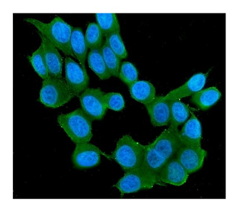 RAB11B Mouse Monoclonal Antibody
