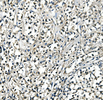 ATP5H in Mouse Monoclonal Antibody