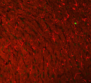 GFAP Mouse Monoclonal Antibody