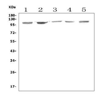 Aryl hydrocarbon Receptor/Ahr Rabbit Polyclonal Antibody