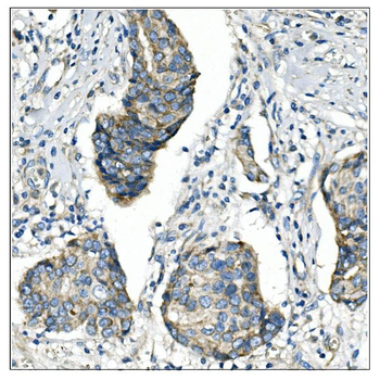 Angiopoietin-2/ANGPT2 Antibody