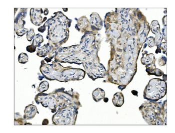 Angiopoietin-2/ANGPT2 Antibody