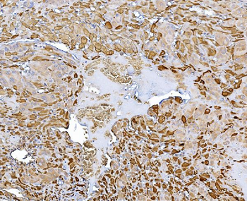 Choline Acetyltransferase/CHAT Rabbit Polyclonal Antibody