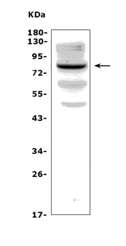 Choline Acetyltransferase/Chat Rabbit Polyclonal Antibody