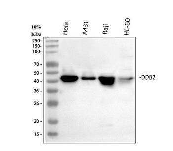 DDB2 Rabbit Polyclonal Antibody