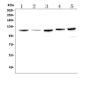 Eph receptor B2/EPHB2 Antibody