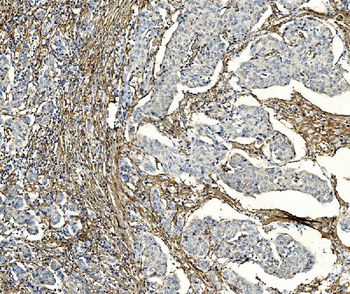PAR1/Thrombin Receptor/F2R Rabbit Polyclonal Antibody