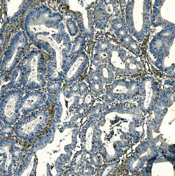 PAR1/Thrombin Receptor/F2R Rabbit Polyclonal Antibody