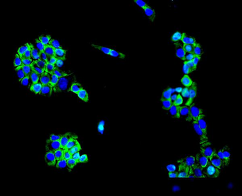 MC4-R/MC4R/MC4 Rabbit Polyclonal Antibody