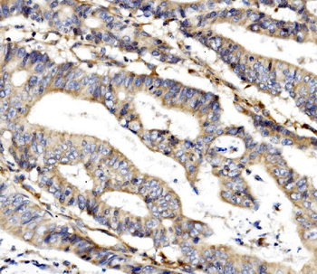MC4-R/MC4R/MC4 Rabbit Polyclonal Antibody