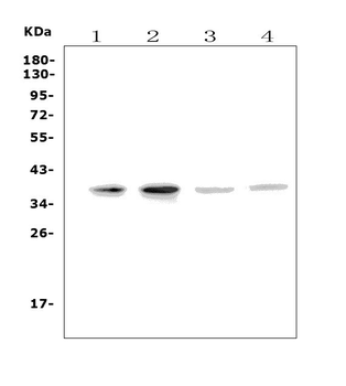 MC4-R/MC4R/MC4 Rabbit Polyclonal Antibody