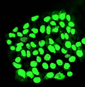 MORC3 Rabbit Polyclonal Antibody