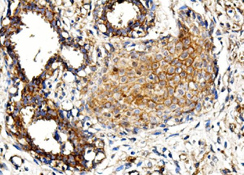 MORC3 Rabbit Polyclonal Antibody