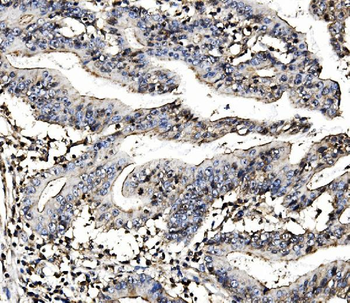 MORC3 Rabbit Polyclonal Antibody