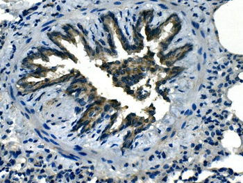 LOX 1/Olr1 Rabbit Polyclonal Antibody