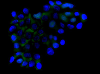 RICTOR Rabbit Polyclonal Antibody