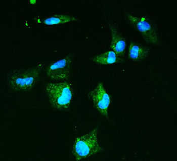 GLUT9/SLC2A9 Rabbit Polyclonal Antibody
