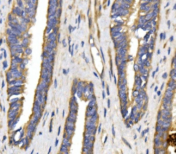 GLUT9/SLC2A9 Rabbit Polyclonal Antibody