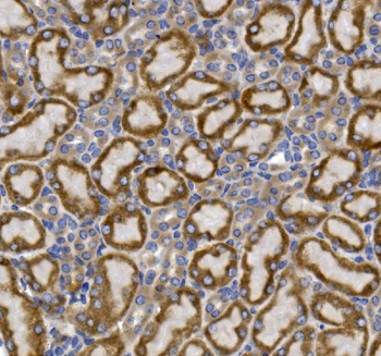 GLUT9/SLC2A9 Rabbit Polyclonal Antibody