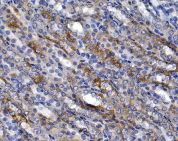 GLUT9/SLC2A9 Rabbit Polyclonal Antibody