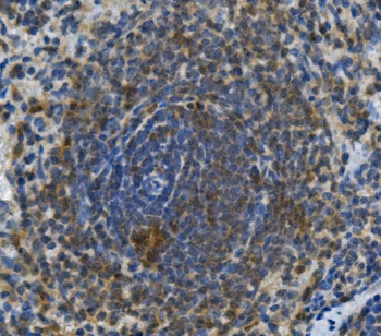 Toll-like receptor 1 TLR1 Rabbit Polyclonal Antibody