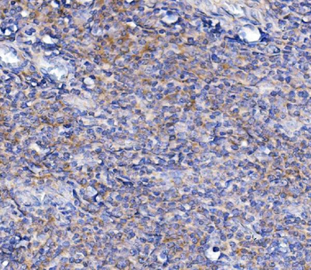 TLR1 TRIM6 Rabbit Polyclonal Antibody